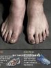 双脚已严重变形！韩媒晒孙兴慜脚部照片